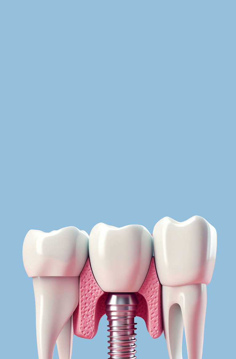 尘埃粒子计数器ODM/OEM/ 代工/贴牌